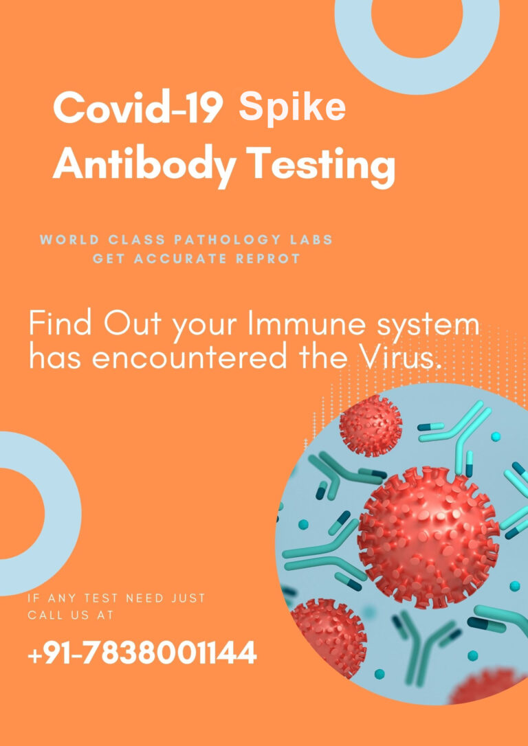 book covid spike antibody test